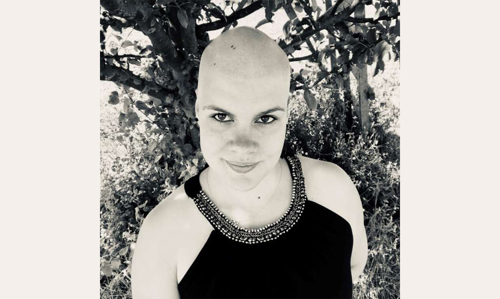 Androgenetische Alopezie – Meine Diagnose