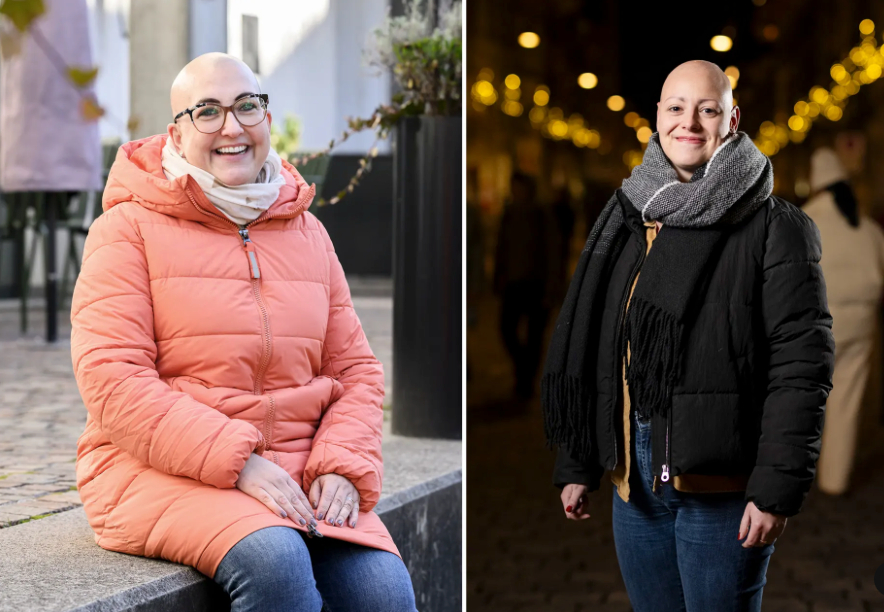 Mut zur Glatze: Wenn Frauen mit Alopezie ihr Leben neu definieren