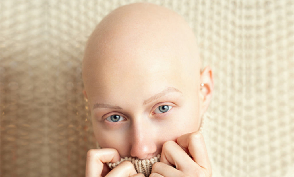 Aus dem Leben eines Alopecianers – Bianca