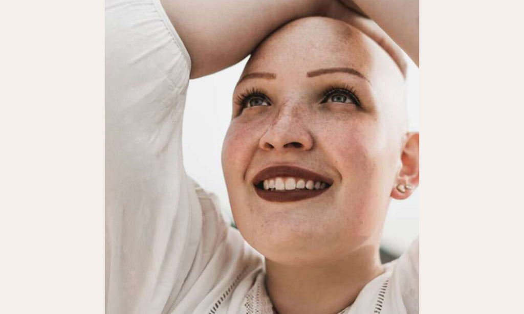 Aus dem Leben eines Alopecianers – Leonie